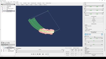 23. Export data to exocad