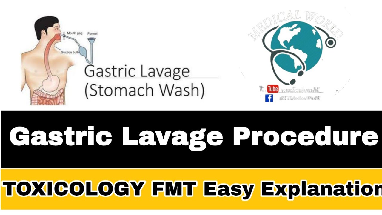 Gastric Lavage Stomach Wash Toxicology (FMT) Easy Explaination