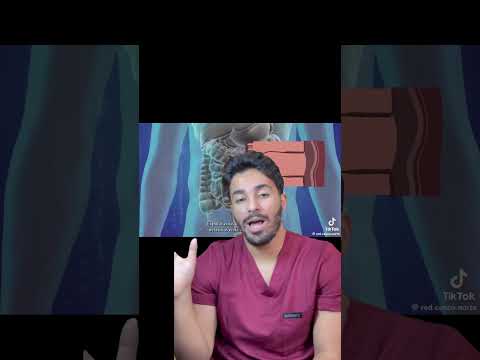 فيروس شلل الاطفال حذاري شرح مبسط للتلقيح الوقائية خير من العلاج الجزائر  الجزائر