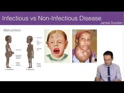 Infectious vs Non-Infectious Disease