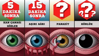 Sonsuza Kadar Göz Kırpmazsak Ne Olur?