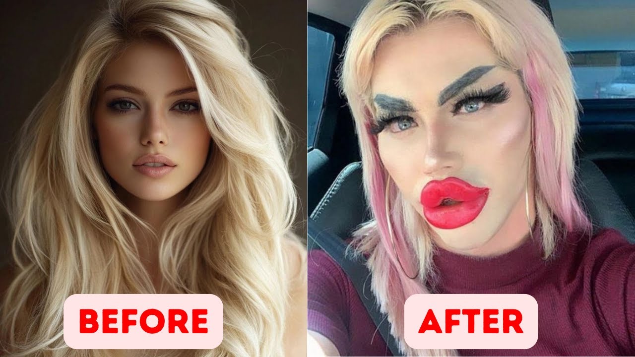 Most Shocking Celebrity Plastic Surgery Disasters Then VS Now YouTube