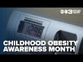 Childhood obesity becoming an epidemic in the United States