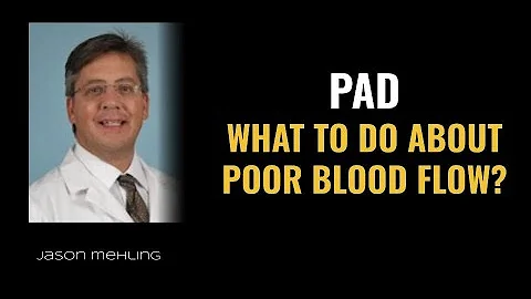 Dr. Jason Mehling and poor blood flow