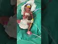 Newborn  shorts ytshorts baby baby.s doctor doctorlife odisha india disease medical