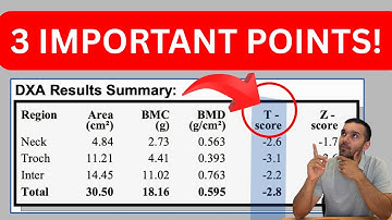 DEXA Scan for Osteoporosis: Bone Mineral Density; What It Is and Why It Matters! #bonehealth