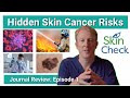 Skin Cancer Risks You Might Miss | GPs &amp; Patients Need to Know | SkinCheck Ep 1 (June 2025)