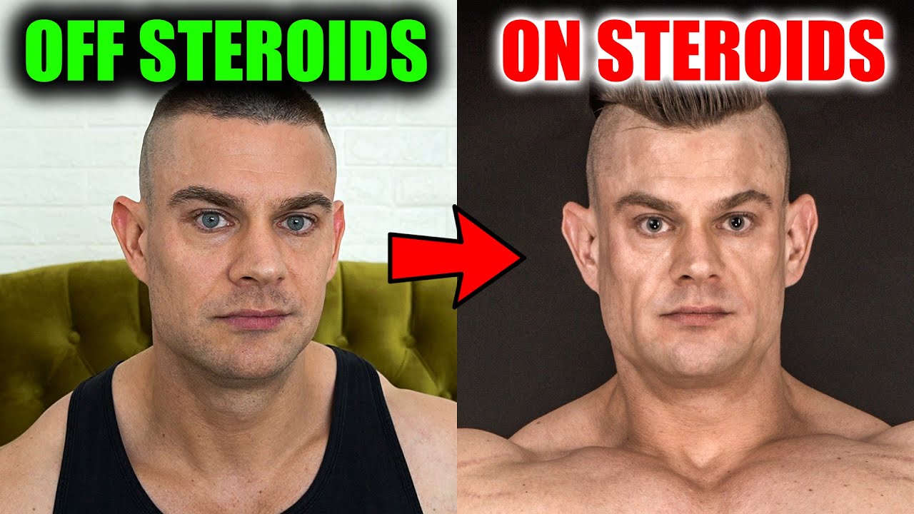 Steroids WILL Age Your Face - Before And After Example - YouTube