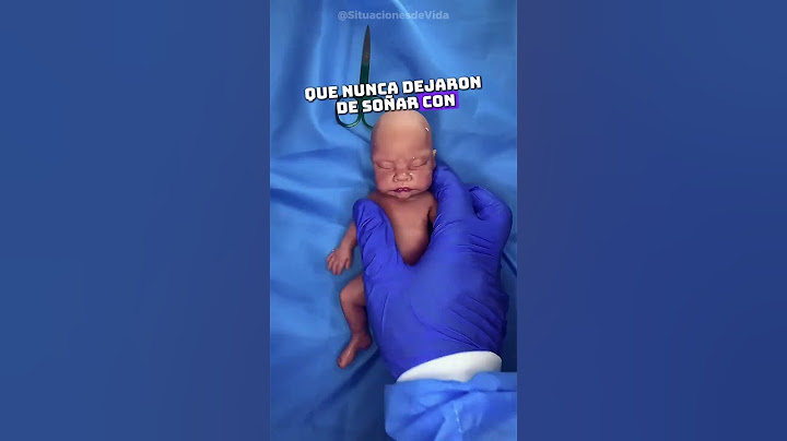 No podrás dejar de mirar a este bebé recién nacido… 😳