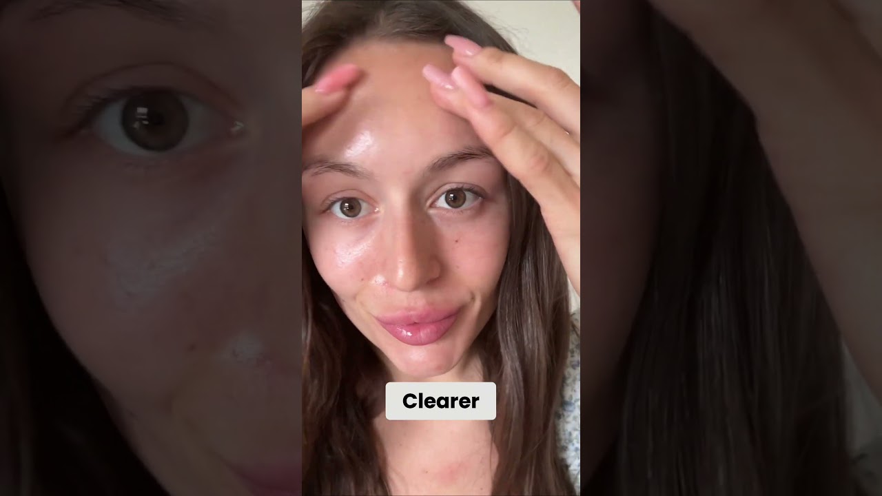 How I cleared bloating, brain fog, and my skin in 3 weeks