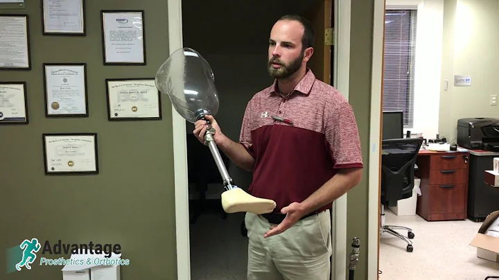 Greg Tacy Shows An Above Knee Prosthesis & Gel Liner