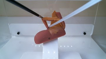 Appendix endoloop and division on Inovus Lap Trainer