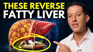 The 5 Best Supplements for Liver Health and Fatty Liver