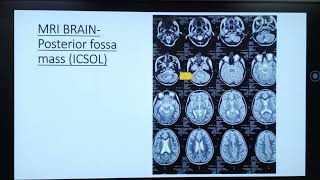 Clinical scenarios in Pediatrics ( mixed Bag)