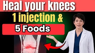 Cartilage Damage? Try This Injection & Eat These 5 Foods Daily |Seniors Health