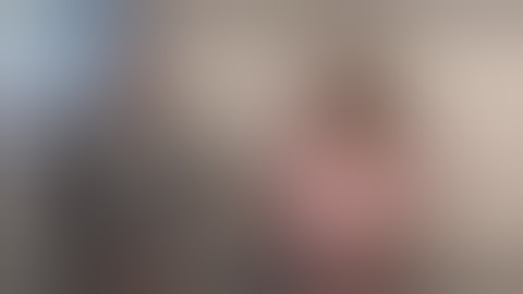 Rapid Recovery No Touch Technique Breast Augmentation