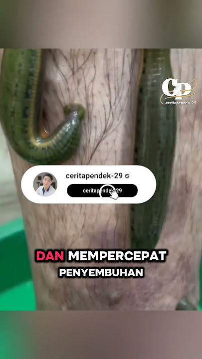 Khasiat terapi lintah untuk kesehatan