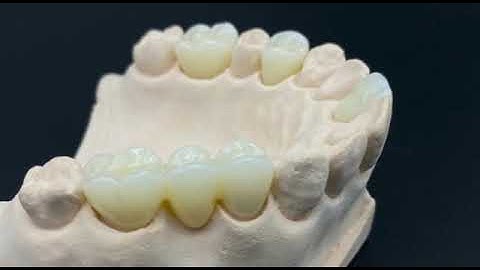 Vsmile 3D pro multilayer  zirconia block. All in one.