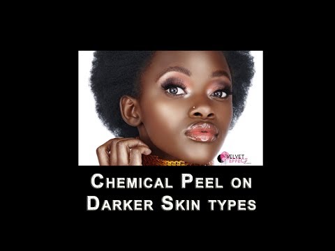 Chemical Peel on Darker Skin types - YouTube