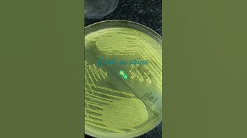 E.coli in urine #uti #urinaryinfection #urinarytractinfections #bacteria #bacterialculture