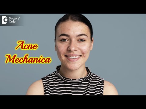 What is Acne Mechanica? Causes, Treatment, and Prevention - Dr. Rasya Dixit |Doctors&rsquo; Circle