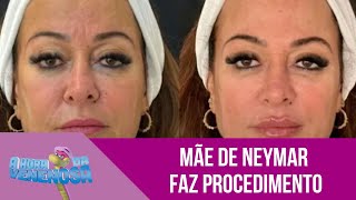 Mãe de Neymar, Nadine Gonçalves faz novo procedimento estético no rosto avaliado em 7 mil euros