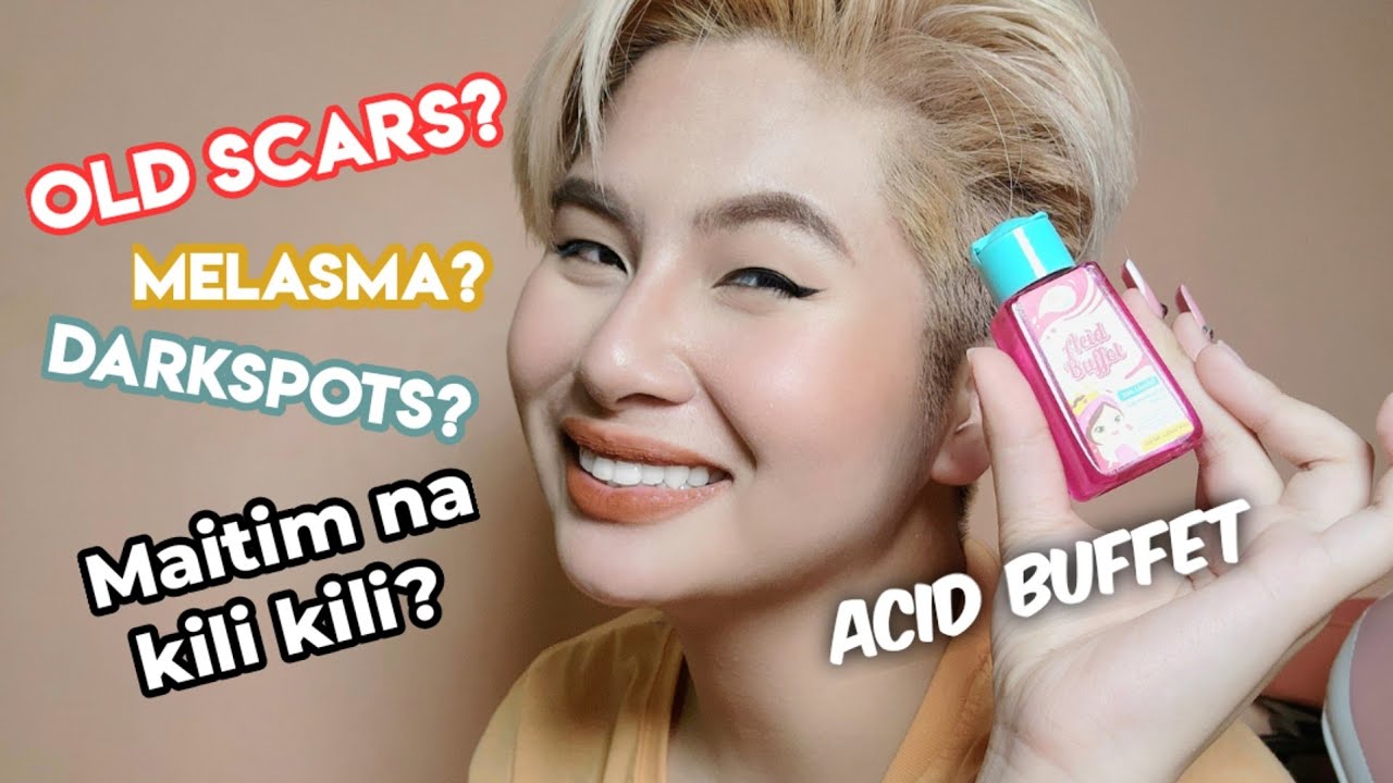 ACID BUFFET QUEEN WHITE |Melasma, Acne Scars, Darkspots Treatment - YouTube