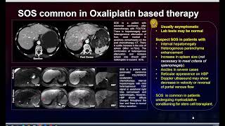 Abdominal Case Conference 2026 - Session 8 screenshot 3