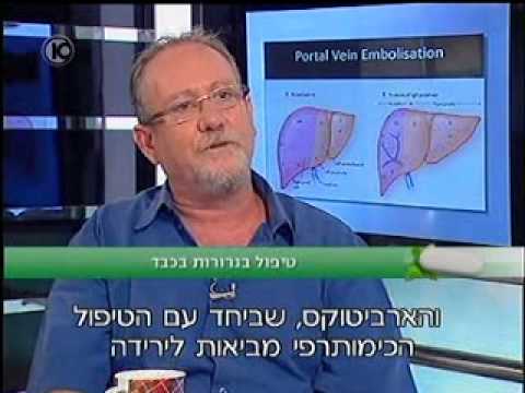 פרופ&rsquo; קרסו | טיפול בגרורות בכבד