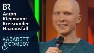 Aaron Kleemann Kreisrunder Haarausfall Kabarett Aus Franken Br Kabarett