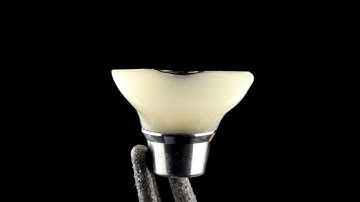 Custom Healing Abutment Design in 3Shape