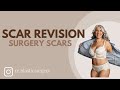 Scar Revision for Surgery Scars | Re. Plastic Surgery