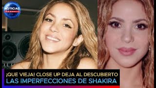 Qué Vieja Close Up Indiscreto Deja Al Descubierto Las Imperfecciones De Shakira Y Desata Lo Peor