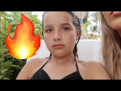 We All Got Burned 🔥 (WK 343.3) | Bratayley