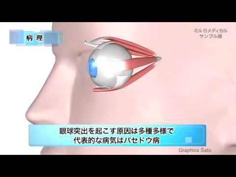 眼球突出／ミルメディカル　家庭の医学 動画版