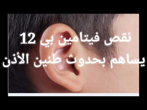 نقص فيتامين بي 12 يساهم بحدوث طنين الأذن