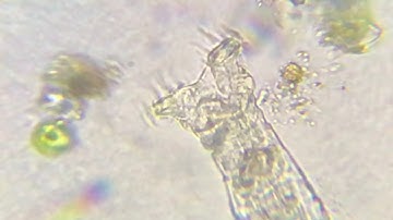 All about ROTIFERS! Including slow motion footage of the corona!