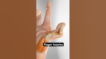 Twee vreemde vingerblessures die je moet kennen