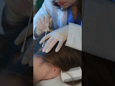 ASMR Scalp Treatment