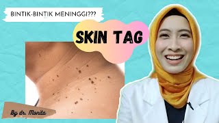 Tips for removing skin tags at home | by Monita, MD (with Eng Sub)