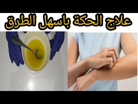 فيديو: كيفية وقف عدوان الكلب نحو الكلاب الأخرى