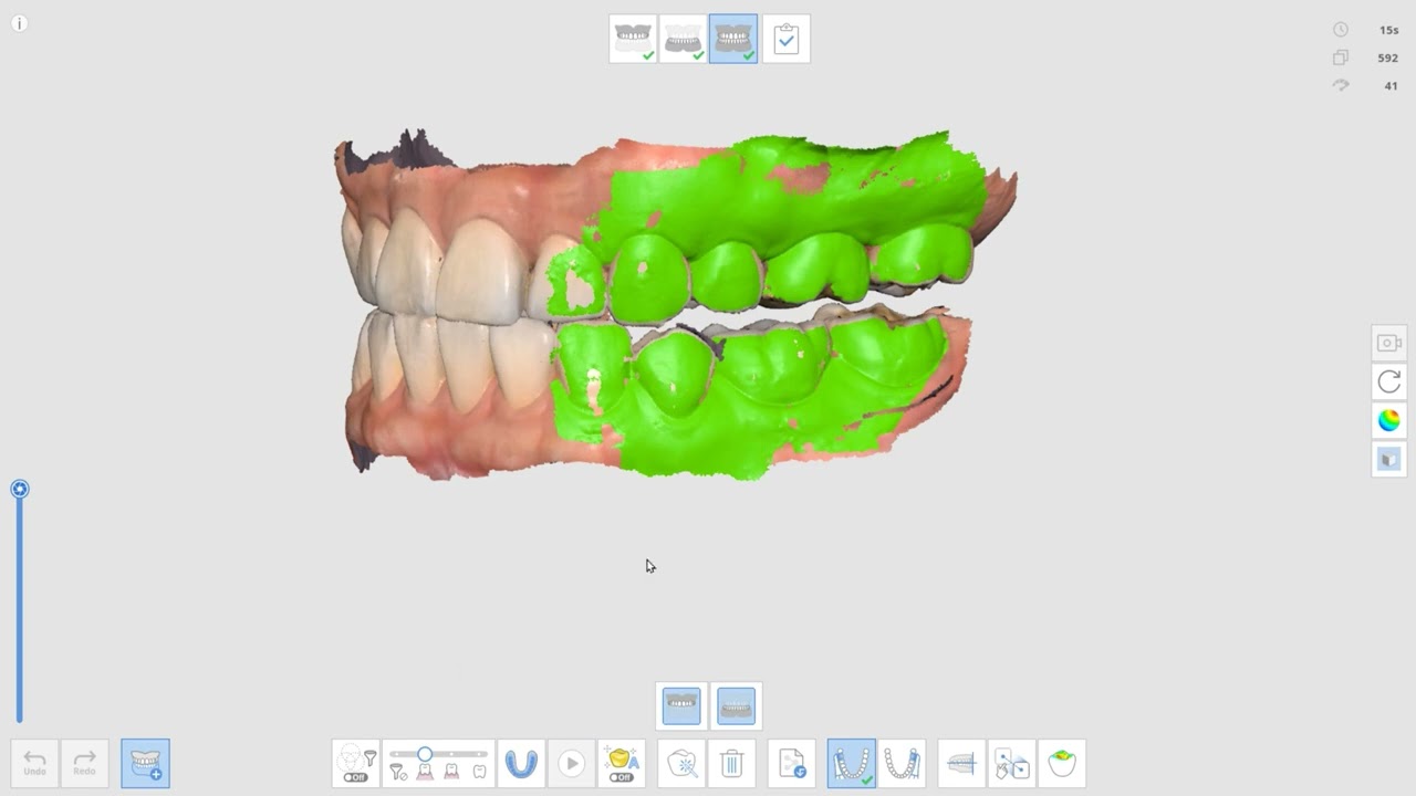 Multi Occlusion (ENG) - YouTube