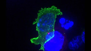 Killer T cell attacking cancer