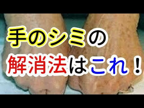 【美容健康】手のシミの解消法はこれ!【知ってよかった雑学】【ほんまかチャレンジ】