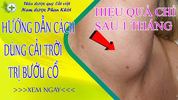Hướng dẫn cách dùng cải trời trị bướu cổ, hiệu quả chỉ sau 1 tháng