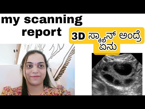 3D ಸ್ಕ್ಯಾನ್  ಅಂದ್ರೆ ಏನು,ಶಿವಮೊಗ್ಗ ದಲ್ಲಿ ಸ್ಕ್ಯಾನಿಂಗ್  ಸೆಂಟರ್ / my scanning report after a year