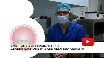 Cosa è meglio trasferire embrioni o blastocisti?