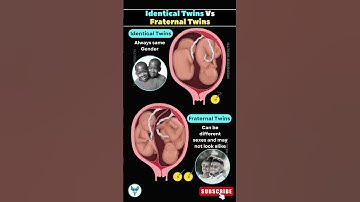 Identical vs Fraternal Twins A Look Inside the Womb | twin development stages #shortsfeed #love