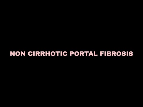 Non cirrhotic portal fibrosis|Pathology
