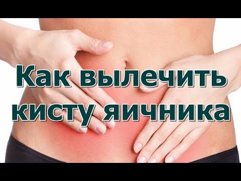 Как вылечить кисту яичника